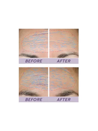 Mary Kay TimeWise Repair® Volu-Firm® Set